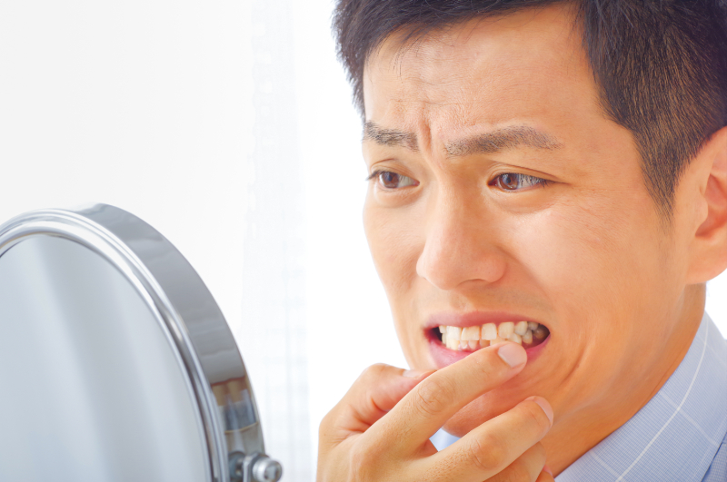 前歯の虫歯を自分でチェックする男性