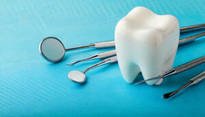 歯医者の定期検診のイメージ