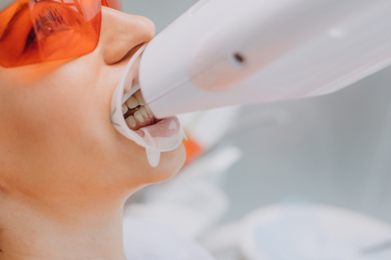 ホワイトニングの照射を受ける様子