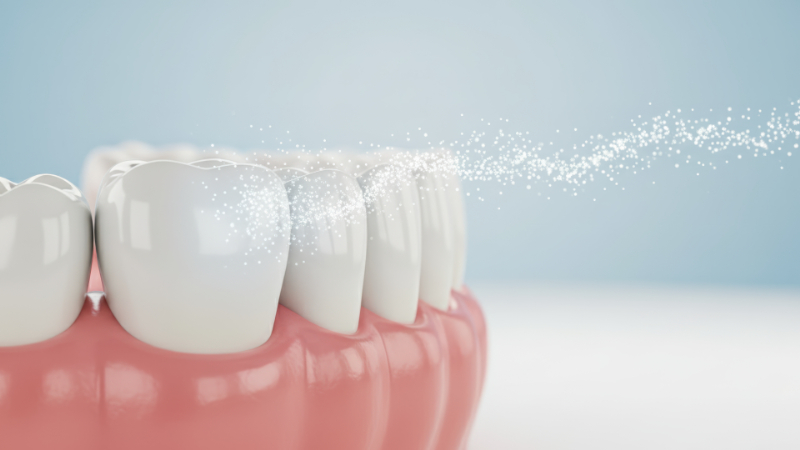 フッ素を塗布して虫歯予防をするイメージ