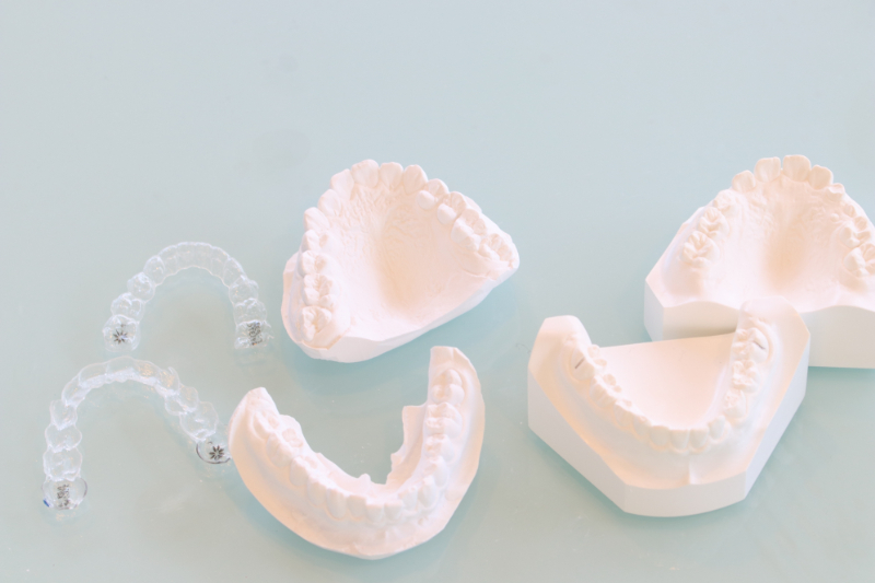 歯の型取りとマウスピース